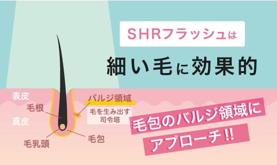 SHR脱毛とは？